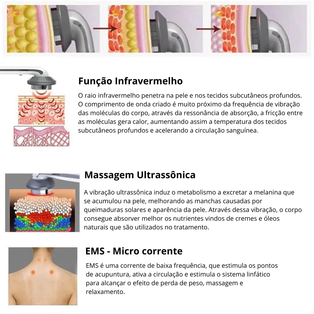 Lipocavitação Ultrassônica Para Redução De Gordura E Celulite